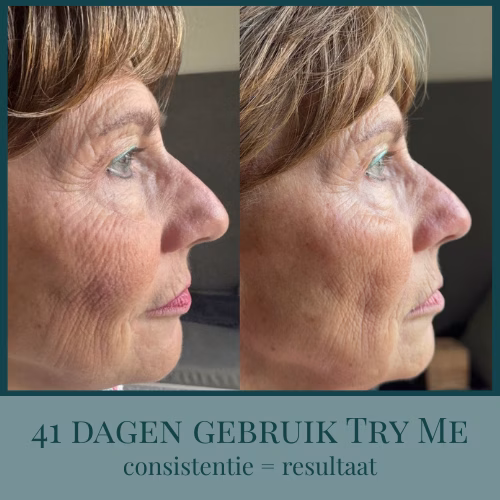 Try Me Skincare Pakketje – Krappa & Abrikozenpitolie - Afbeelding 2